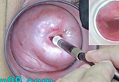 Japanese Endoscope Camera inside Cervix Cam into Vagina
